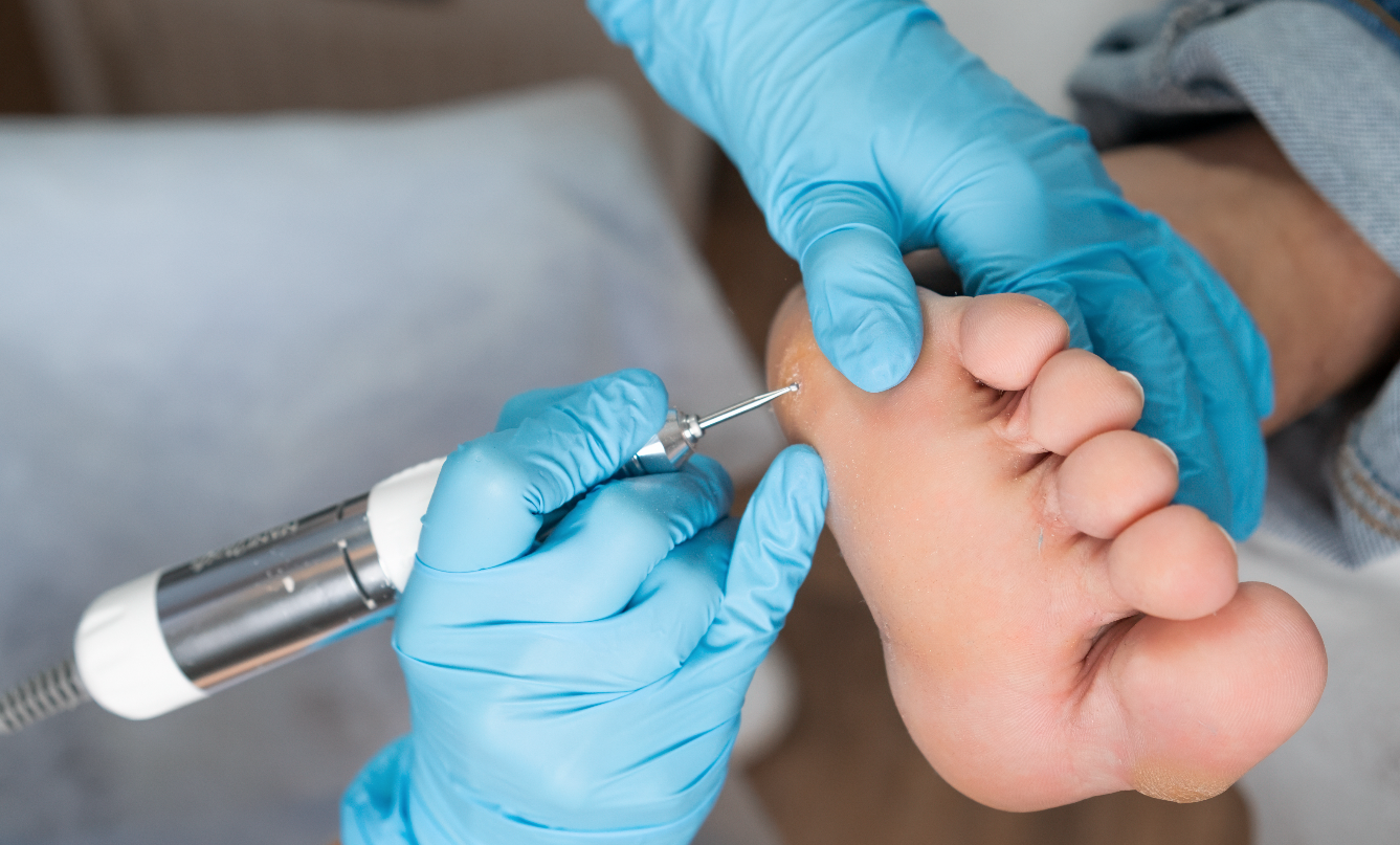 Marketing digital y SEO para atraer pacientes a podólogos